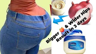 Just One  Onion Will Change Your  Life. || Butt Enhancement cream for Bigger Butt and wider Hips