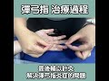 彈弓指物理治療，治療方法 梁凱雯 物理治療師 together physio