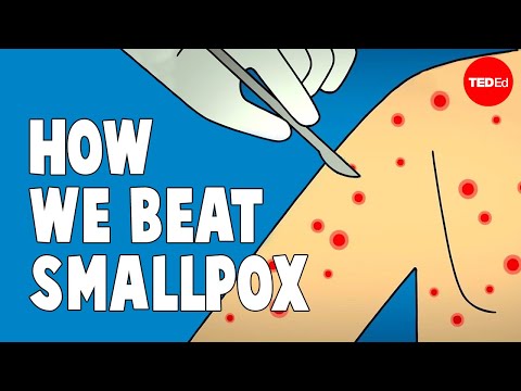 How we conquered the deadly smallpox virus - Simona Zompi How we conquered the deadly smallpox virus - Simona Zompi