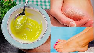 Intan bes kuqurxi lugaha lugo soft ah 1 week bes | How to make your feet soft \u0026 smooth at Home