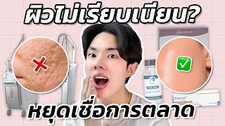 รักษาหลุมสิว ผิวไม่เรียบเนียนแบบเห็นผล ไม่ขายฝัน! สกินแคร์ เลเซอร์ ฟิลเลอร์ หัตถการ เลือกอะไรดีสุด?!