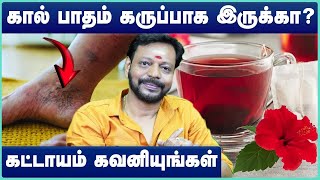 Use Your Feet As Warning Signs | REASONS FOR BLACKENING OF LEGS | MAYAN SENTHIL | Cosmo Health