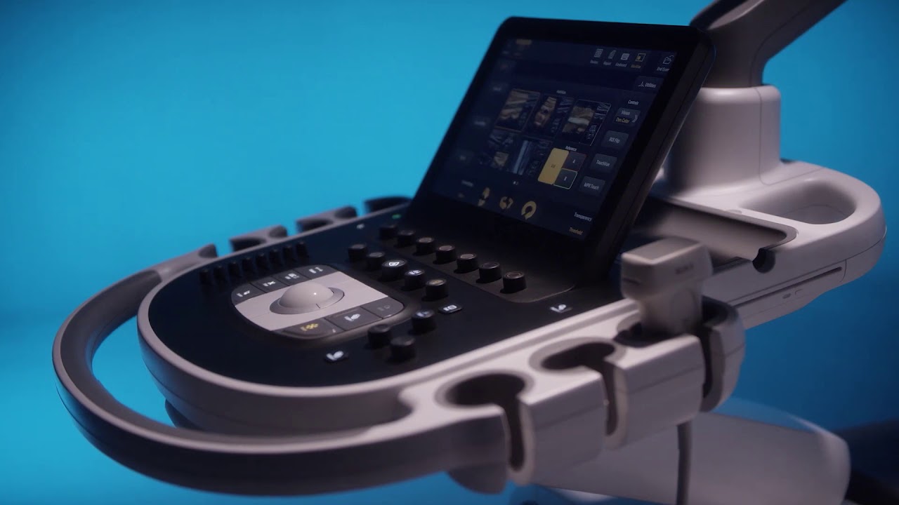 The All New Philips Epiq Elite Ultrasound - YouTube