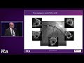 Left main bifurcations: latest clinical data applied to practical cases - EuroPCR 2022