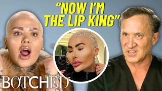 Botched “Lip King” Jordan Returns To Visit With Dr. Terry Dubrow & Dr. Paul Nassif | Botched | E!