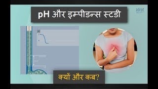 pH और इम्पीडेन्स स्टडी: क्यों और कब की जाती है ? pH with Impedance study Hindi