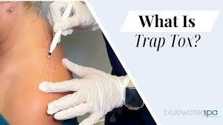 What is Trap Tox? || Blue Water Spa