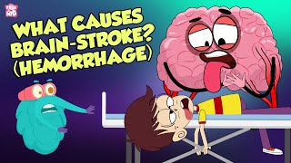 What Causes A Brain Stroke? | Brain Attack | The Dr Binocs Show | Peekaboo Kidz
