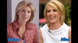 Laura Ingraham Plastic Surgery: Nothing More Than A Gossip
