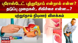 Apollo Proton Cancer Center | புரோஸ்டேட் புற்றுநோய் என்றால் என்ன?  Prostate Cancer | Prostate Gland