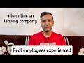 4 lakh fine on leaving company before completing 2 years bond period | Hyderabad based startup