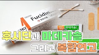 후시딘과 마데카솔! 원리와 효과는? 먹어도 될까?