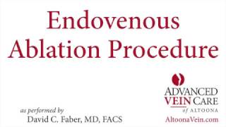 Endovenous Ablation Procedure