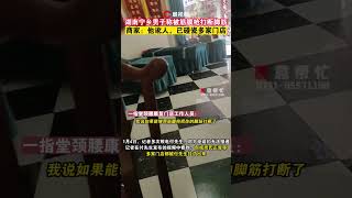 看病也能碰瓷？湖南寧鄉一男子稱被筋膜槍打斷腳筋，頸腰康復門店：他訛人，已碰瓷多家門店 #shorts 👉歡迎訂閱【瀟湘晨報】 #瀟湘晨報 #社會新聞 #中國新聞 #社會日常 #shorts