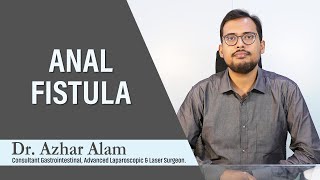 What is Anal Fistula ? | Laser Treatment of Anal Fistula in Kolkata and Benefits | Dr Azhar Alam