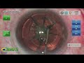 Using the FEMTO LDV Z8 to handle posterior polar Cataract by Dr. Moraru