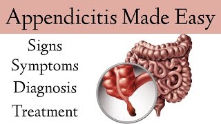 Appendicitis Signs, Symptoms, Examination, Diagnosis, Treatment [Nursing & Medical]