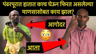 पंढरपूर कॉलेज समोरील मनोरुग्णासोबत काय झालं ? | Team Bhf | @BeingHumanPandharpur