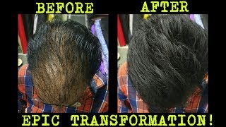 UNBELIEVABLE SOLUTION SEE FOR YOURSELF - Kerrato hair fibers real life demonstration