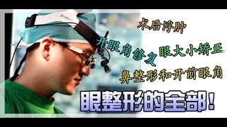 术后浮肿、眼型矫正、开眼角修复，眼整形你想知道的一切！！