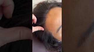 SCATTER scalp semipermanent hairline