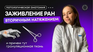 Патологическая анатомия | Заживление ран вторичным натяжением и причем тут грануляционная ткань