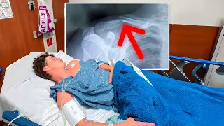 I Broke My Collarbone…