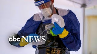 US coronavirus death toll tops 150,000