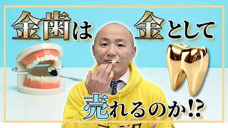 金歯は金として買取可能？歯がついていても安心の買取方法を解説！｜リファスタ