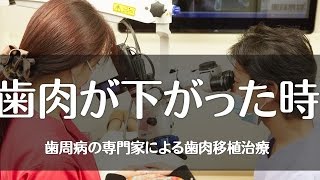 川口市・蕨市・草加市で歯肉移植なら吉野歯科医院「京浜東北線川口駅徒歩3分」