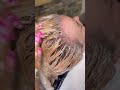 Removing dark hair color