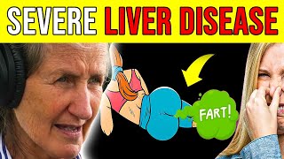 17 SIGNS that your LIVER is DYING | DANGEROUS! | Barbara O'neill