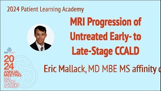 18   MRI Progression of Untreated Early  to Late Stage CCALD - Mallack