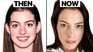 Truth Behind Anne Hathaway Look | Plastic Surgery Analysis