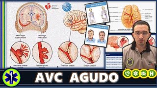 ACIDENTE VASCULAR CEREBRAL AGUDO (INFORMAÇÕES IMPORTANTES)