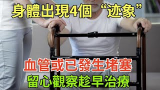 身體出現4個“迹象”，血管或已發生堵塞，留心觀察，趁早治療#健康常識#養生保健#健康#健康飲食