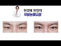 무쌍 눈매교정 부작용 의사의 전문성 숙련도에 결정됩니다