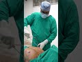 gynecomastia surgery cost shortvideo short dezireclinicindia