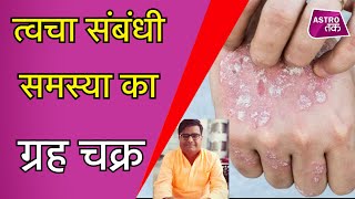 त्वचा संबंधी समस्या किस ग्रह से होते हैं और इससे बचने के लिए क्या करें |Shailendra Pandey|Astro Tak