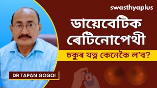 ডায়েবেটিক ৰেটিনোপেথী: চিকিৎসা | Diabetic Retinopathy, in Assamese | Eye Disease | Dr Tapan Gogoi