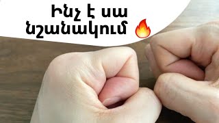 Ինչ է սա նշանակում 🔥 / հարստություն/ աղքատություն և աչքերի տեսողության ուղղում