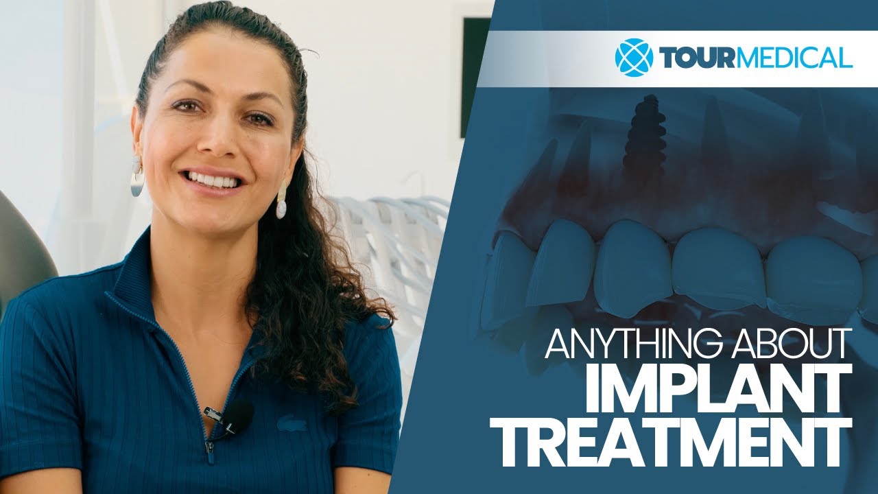 Anything About Implant Treatment Youtube