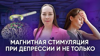 Транскраниальная магнитная стимуляция для лечения депрессии, ОКР, шизофрении @evropapsi