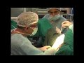 surgical repair of post traumatic stricture buldo membranous urethra dr sanjay kulkarni