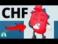 Congestive Heart Failure (CHF) | Quick Medical Definition