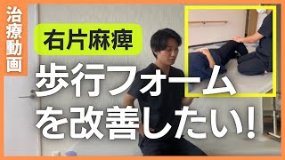 【片麻痺治療解説動画】歩行フォームを改善するための治療方法を解説します〜沖縄脳卒中リハビリセンターホコトレ〜