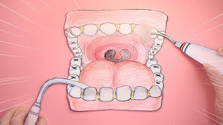 [Stop motion animation] How long have you not cleaned your teeth?