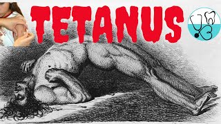 Tetanus - The 7th day disease ( Part 1 ) , Introduction , Types , Transmission