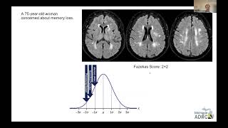 Mapping Myelin Content With MRI: Existing and Emerging Methods