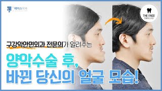 [더페이스치과] 구강악안면외과 전문의가 알려주는 양악수술 후, 바뀐 당신의 얼굴 모습!